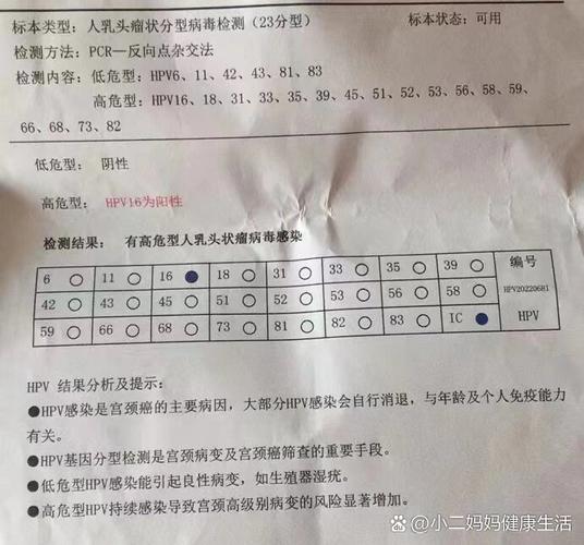 鳞状上皮细胞高是什么意思,“鳞状上皮细胞高值解析”