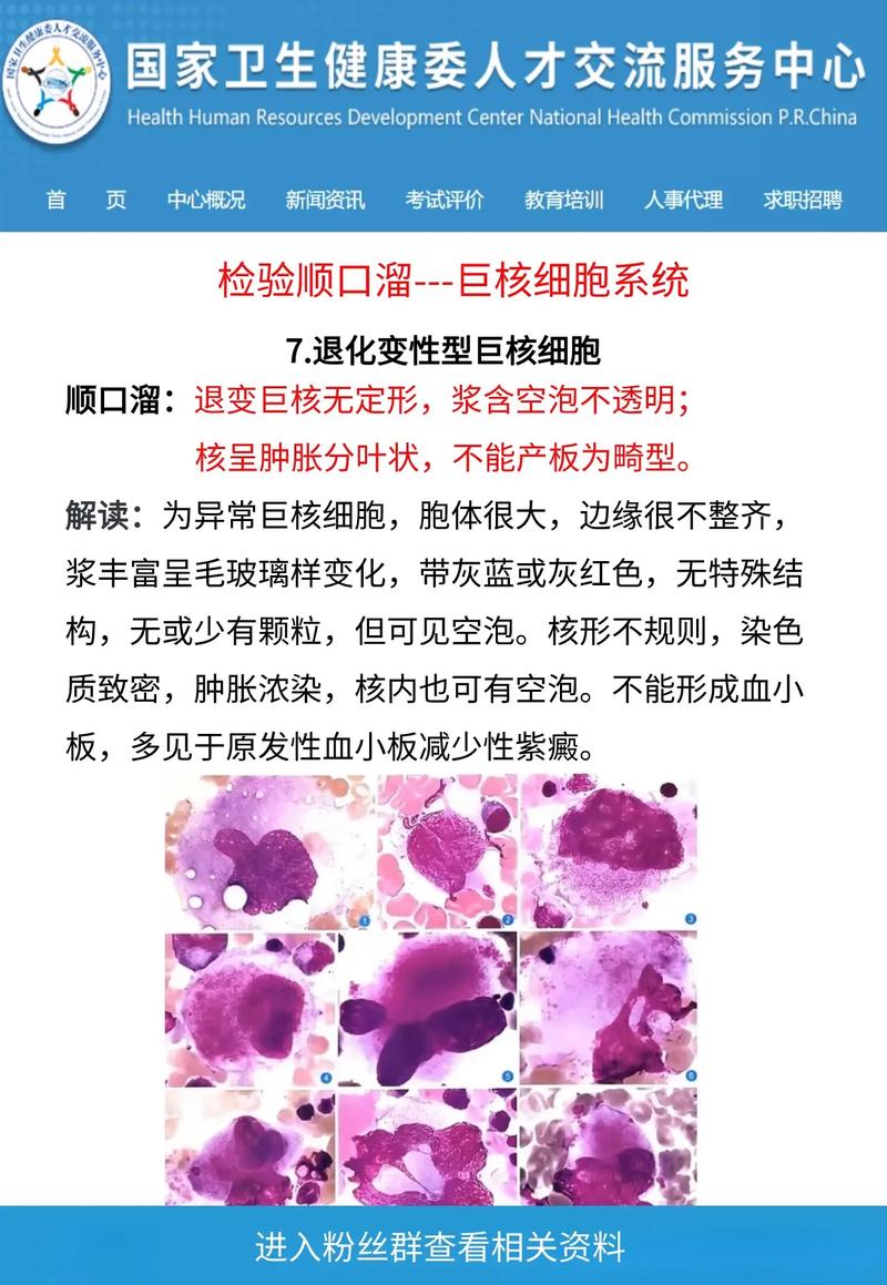 巨核细胞成熟障碍能治好吗,巨核细胞成熟障碍治疗有效方法