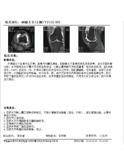 巨细胞瘤是什么引起的,巨细胞瘤成因揭秘